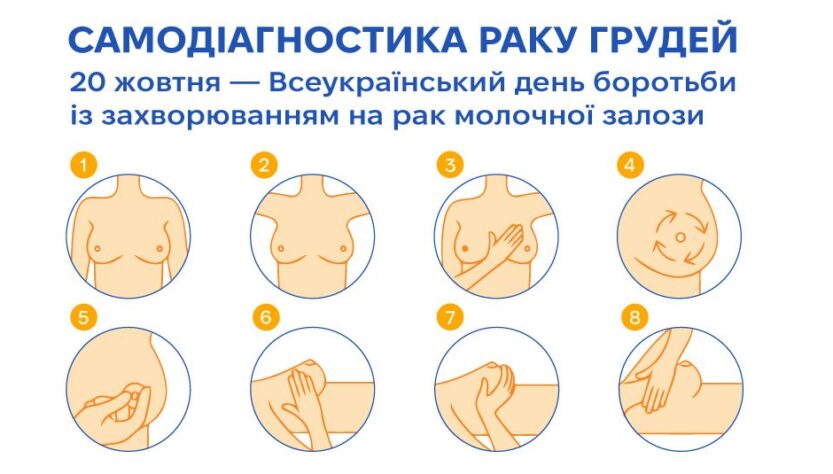 Рак молочної залози: як розпізнати та запобігти